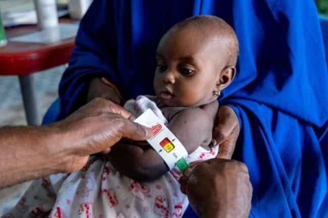 신체검사 받는 나이지리아 아동